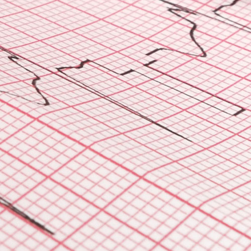 ecg paper type