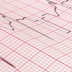 ecg paper type