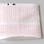foetal monitor printing paper